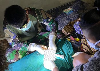 Alat Vital Tidak Normal, Dokter Satgas Yonif 527 Baladibya Yudha Lakukan Khitan Darurat